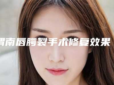 渭南唇腭裂手术修复效果怎样价格贵吗